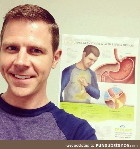 When you realise that you are the acid reflux model