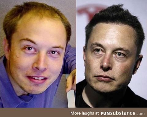 Elon Musk before and after Neuralink implants
