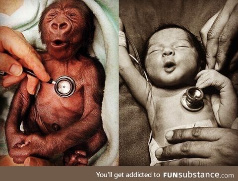 Baby human and baby gorilla reaction to a cold stethoscope
