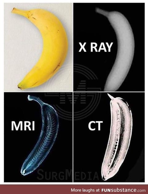 Banana for scan