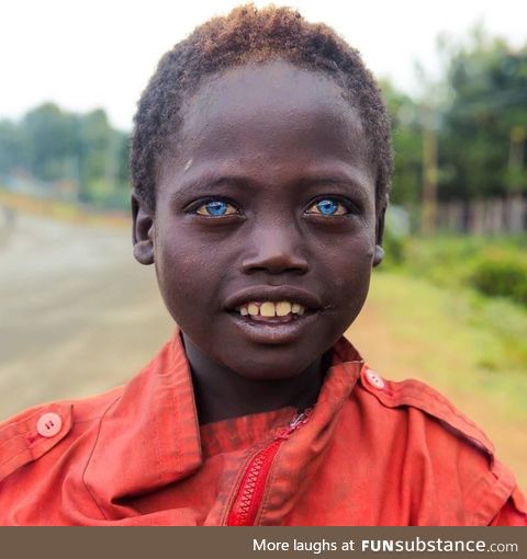 Ethiopian boy with blue eyes