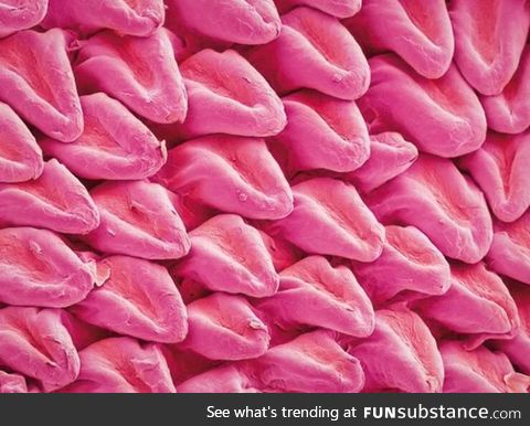 A cats tounge underneath a Electron Microscope