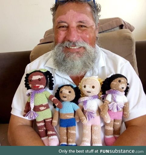 This Grandfather with Vitiligo crochets Dolls for Children with the Condition