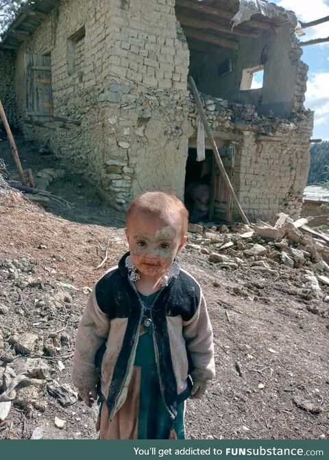 This little girl is the only remaining member of her family after an earthquake struck