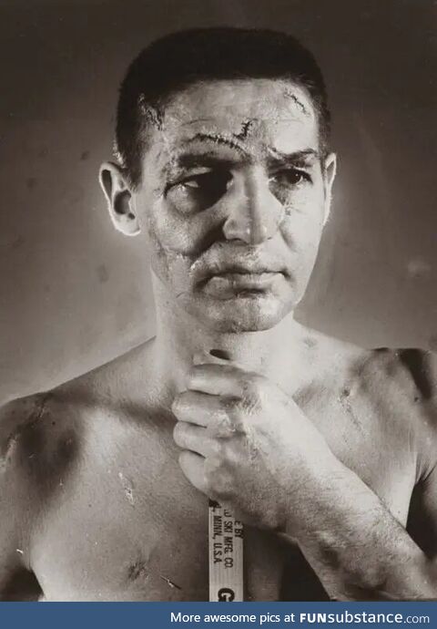Terry Sawchuk – The face of a hockey goalie before masks became standard game