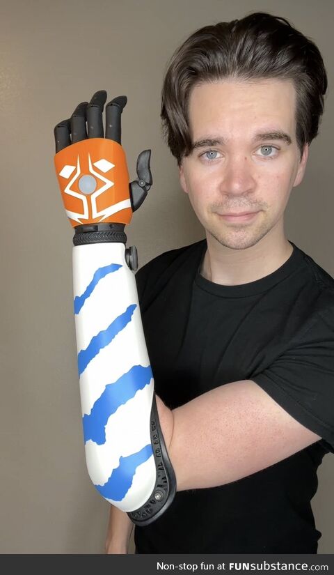 I made an Ahsoka-inspired cover for my bionic arm