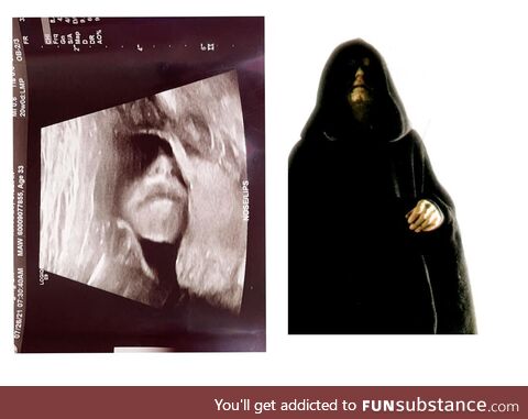 Latest ultrasound confirmed baby is indeed a Sith Lord