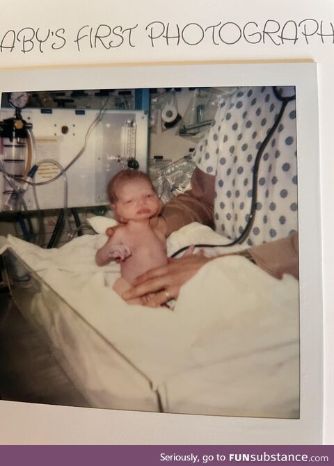 The NICU nurses called me E.T., as did my mother…