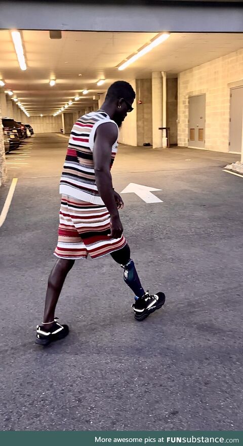 This is whatModern prosthetic look like