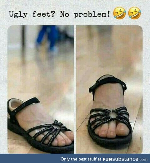 Still not the best looking feet