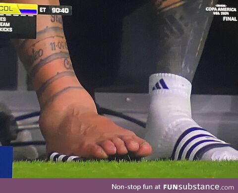 Lionel Messi's Ankle