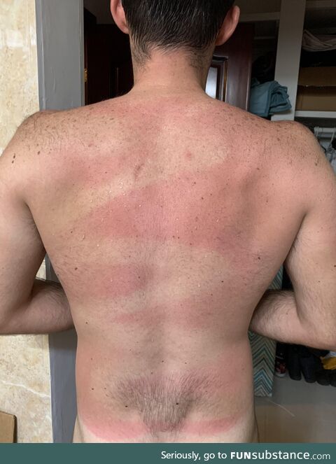 Wife helped spray sunscreen on my back…