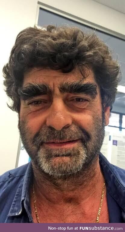 The glorious eyebrows of Tony Galati, the Potato King of Western Australia