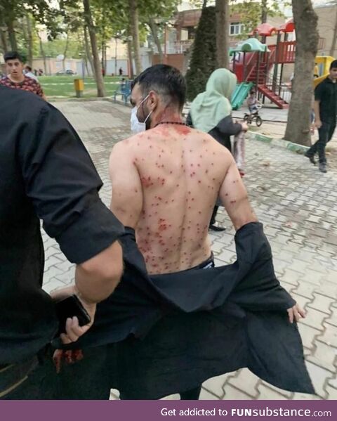 Man shielded many women and took all pallets shotgun on himself during anti hizab protest