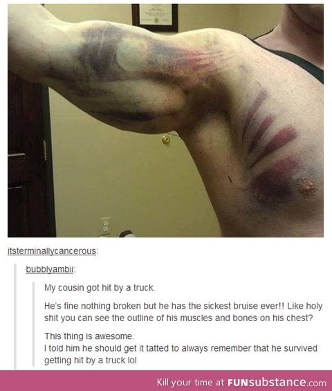 Coolest Bruise