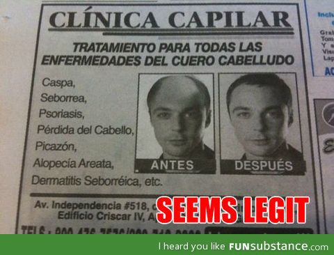 Sheldon cooper hairloss ad